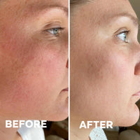 FBC Bakuchiol Night Repair Glow Serum (35% Extra Discount)